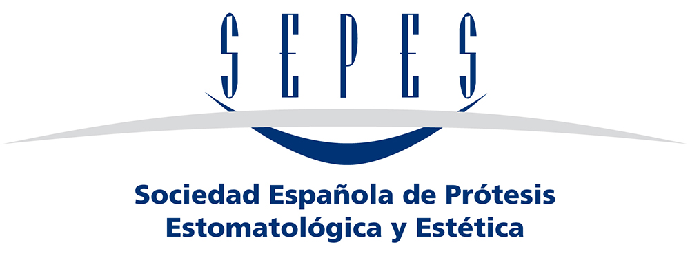 sepes horizontal